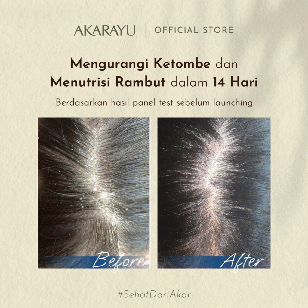 B_A_Ketombe_1