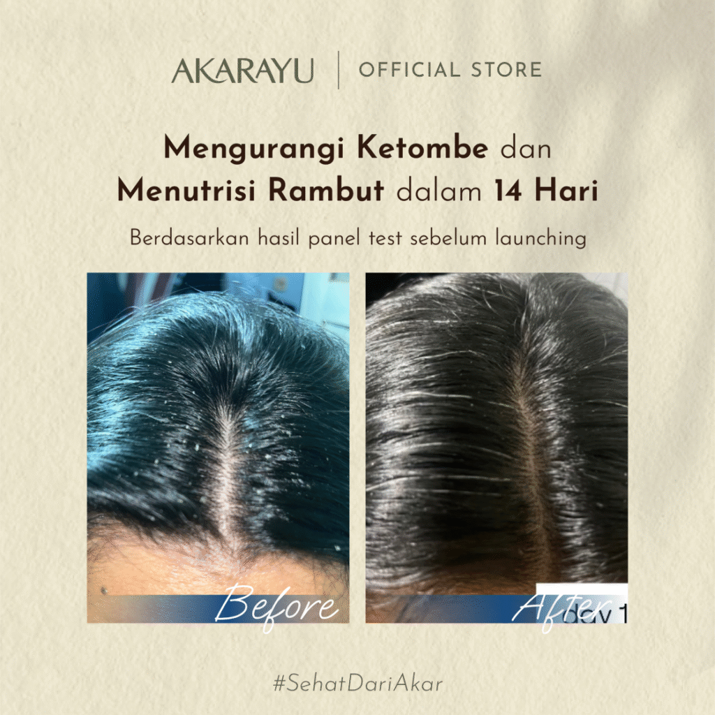 B_A_Ketombe_2