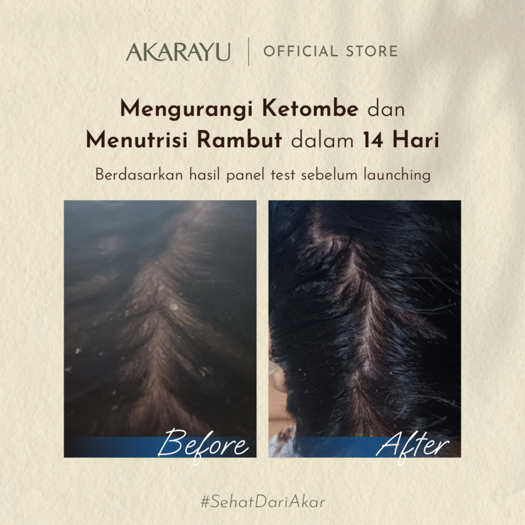 B_A_Ketombe_3